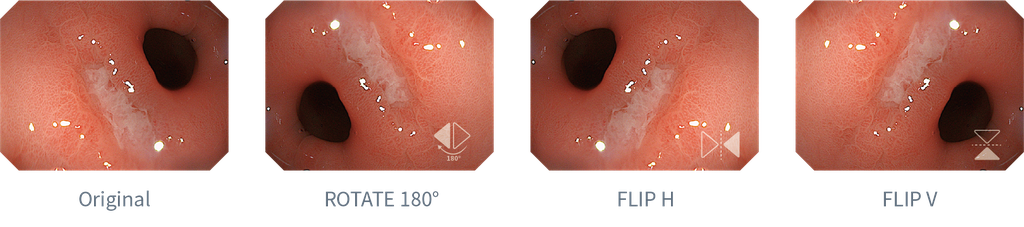 Aohua OR160 EN1 All-in-One Vet Endoscopy System - Image 4