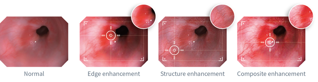 Aohua OR160 EN1 All-in-One Vet Endoscopy System - Image 5